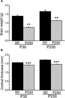 Pre- and postsynaptic alterations in the visual cortex of the P23H-1 retinal degeneration rat model